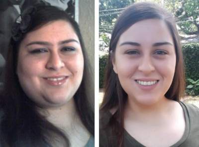 Как меняется внешность людей после похудения. Фото