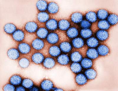 Как распознать ротавирусную инфекцию и что делать до приезда врача