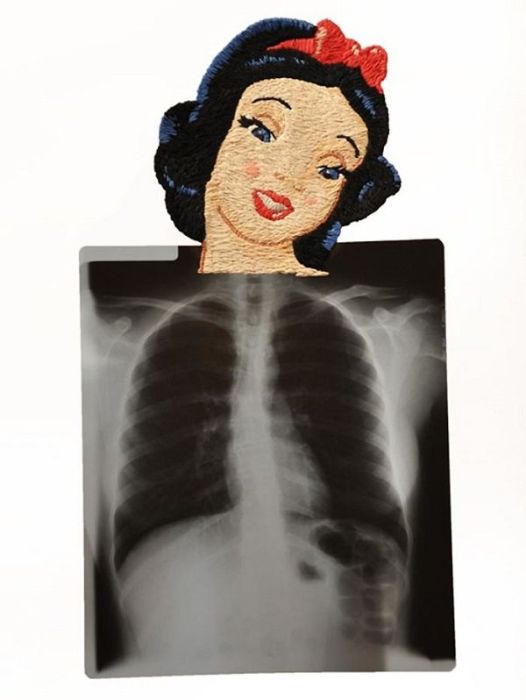 Рентгеновские снимки, дополненные вышивкой