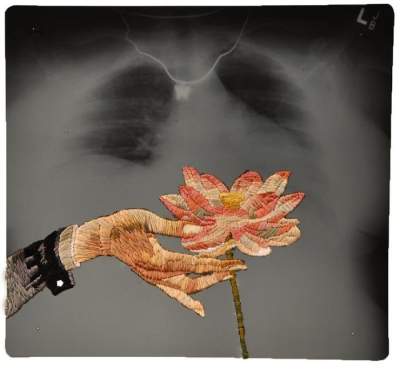 Американец превращает рентгены в невероятные картины. Фото