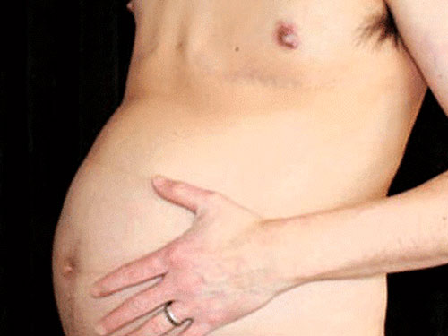 Врачи диагностировали у австралийца беременность