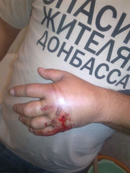 В милиции не заметили, как подстрелили парня в скандальной футболке "Спасибо жителям Донбасса"