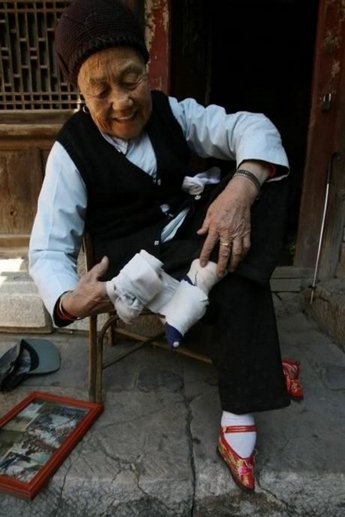 Страшная тайна «золотого лотоса»: фотоистория дикой китайской традиции бинтования ног
