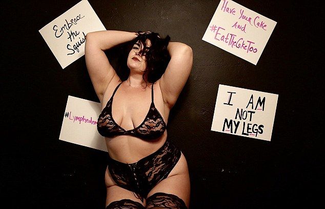 Женщина с опухшими ногами в сексуальном нижнем белье стала сенсацией Instagram