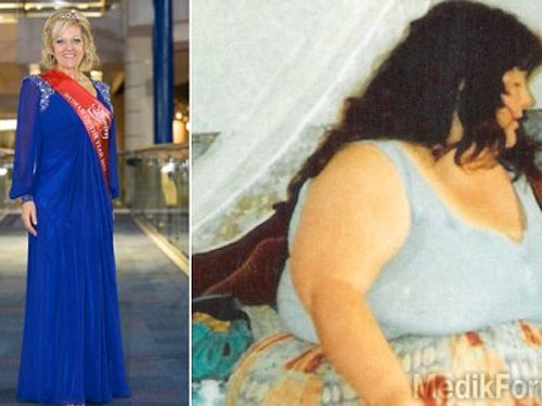 Американка похудела на 130 кг испугавшись, что умрёт через два года 