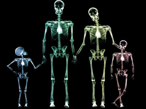 Украинцы первые в мире овладеют технологией сварки человеческих костей