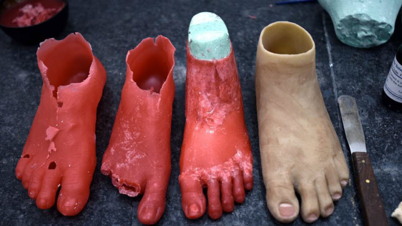 3D-печать протезов приходит в Индию