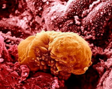 Ученые обнаружили новую разновидность иммунных клеток