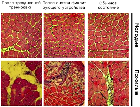 Ученые показали, что старение можно замедлить  