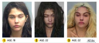 Результат на лицо: снимки людей, разрушивших себя наркотиками. Фото