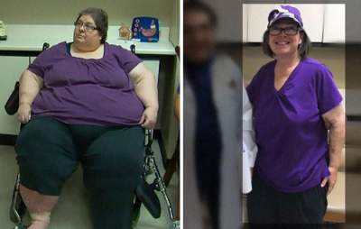 Впечатляющие успехи людей, сбросивших более половины лишнего веса. Фото