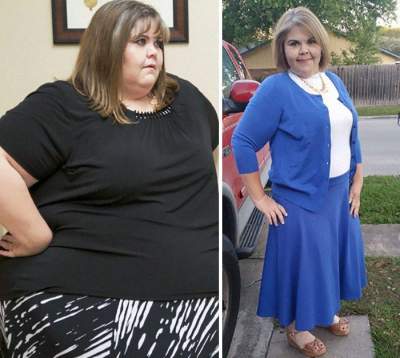 Впечатляющие успехи людей, сбросивших более половины лишнего веса. Фото