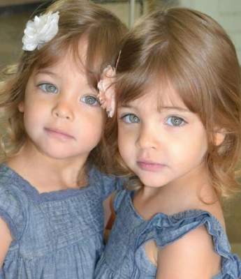 Этих близняшек называют самыми красивыми в мире. Фото