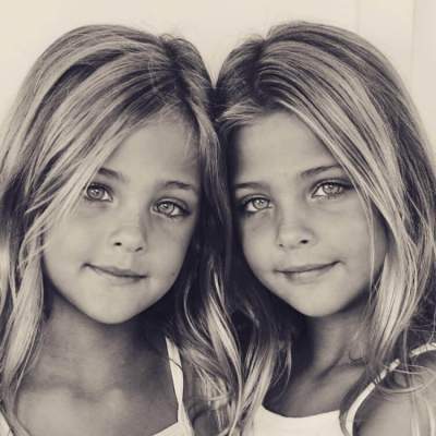 Этих близняшек называют самыми красивыми в мире. Фото