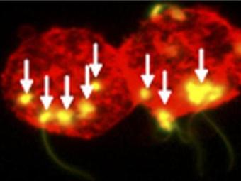 Сперматозоиды с ВИЧ (указаны стрелками) прикрепленные к дендритным клеткам (выделены красным)