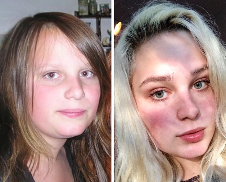 15 человек, переживания которых из-за внешности в подростковом возрасте были лишними