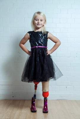 Семилетняя девочка без ног стала популярной моделью. Фото