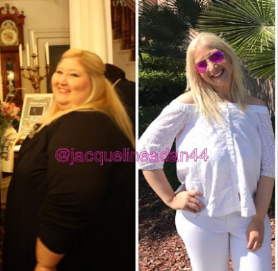 Девушка столкнулась с новой проблемой, похудев на 160 кг. Фото