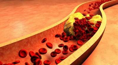 Медики развенчали миф о вреде холестерина