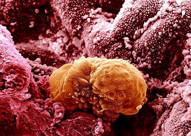 Снимки человеческих органов под микроскопом