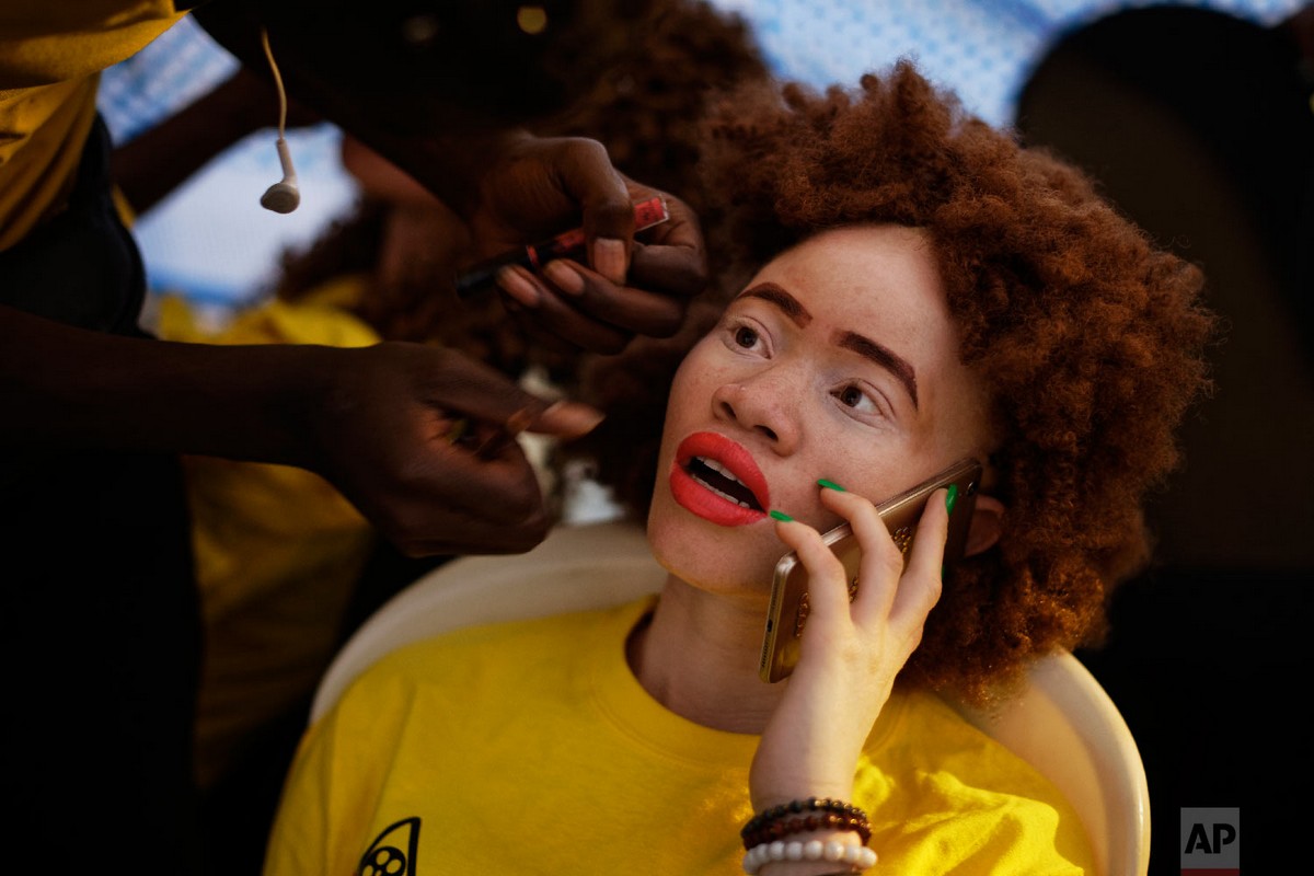 Конкурс красоты для людей с альбинизмом 2018