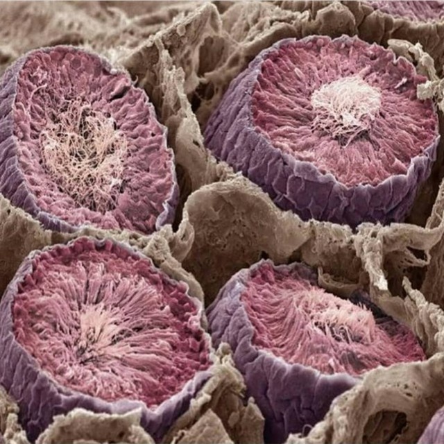 Интересные снимки разных вещей под микроскопом