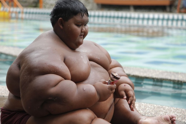 12-летний индонезийский подросток похудел на 95 килограмм