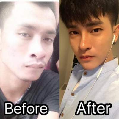 Таиландец сделал 30 косметических операций, чтобы стать корейцем 