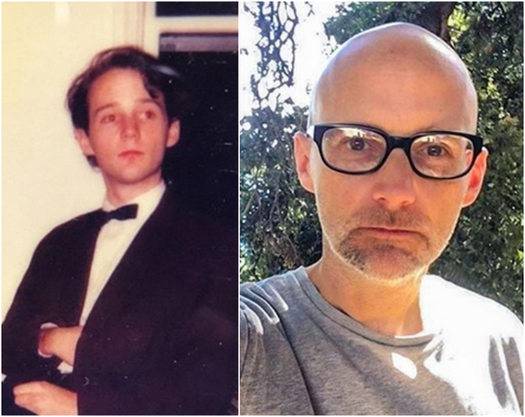 Как выглядели знаменитые лысые мужчины до того, как потеряли свои волосы
