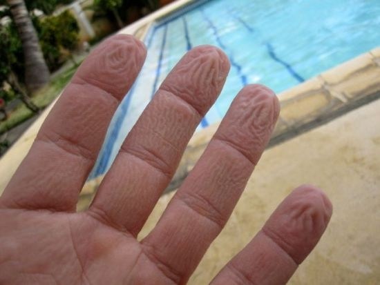 Ученые выяснили, почему в воде морщатся пальцы 