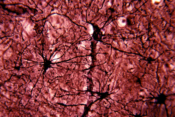 Астроциты — одни из самых многочисленных глиальных клеток, опекающих нейроны. (Фото Dr. John D. Cunningham.)