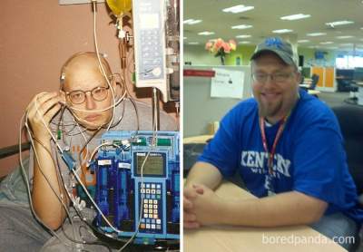 Как изменились люди, победившие рак. Фото