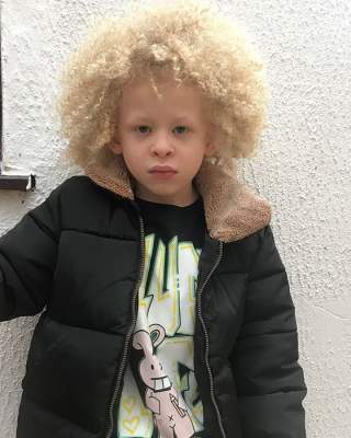 Мальчик-альбинос покорил мир моды. Фото