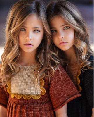 Этих восьмилетних близняшек считают самыми красивыми в мире. Фото