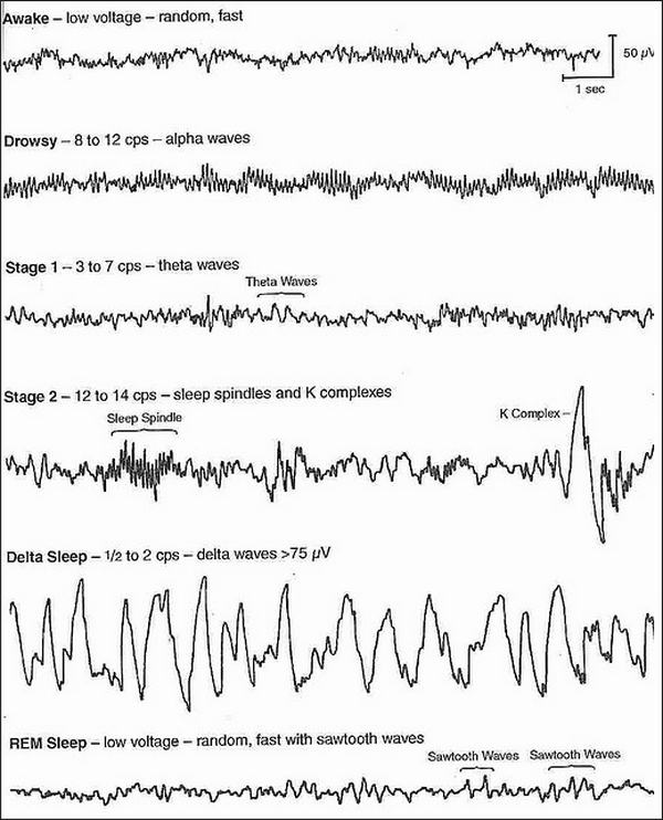 ЭЭГ-ритмы сна и бодрствования; сонные веретёна (sleep spindles) показаны на четвёртом сверху примере