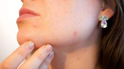 Названы серьезные заболевания, о которых может сигнализировать кожа