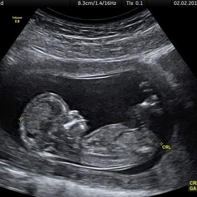Джастин Бибер разыграл поклонников новостью о беременности Хейли Болдуин