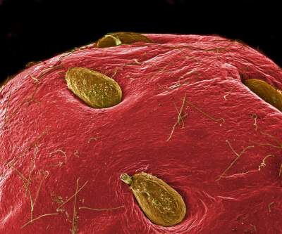 Как выглядит еда под микроскопом. Фото