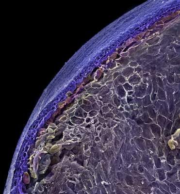 Как выглядит еда под микроскопом. Фото