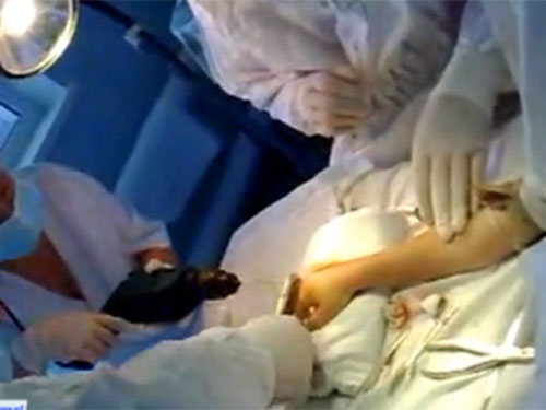 В Молдове хирурги детской больницы проводят операции дрелью и кусачками