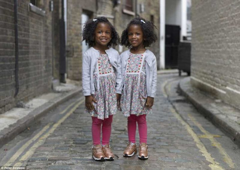 Фотограф показал, какими разными могут быть близнецы. ФОТО
