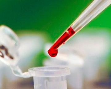 Ученые связали химический состав крови с достатком человека