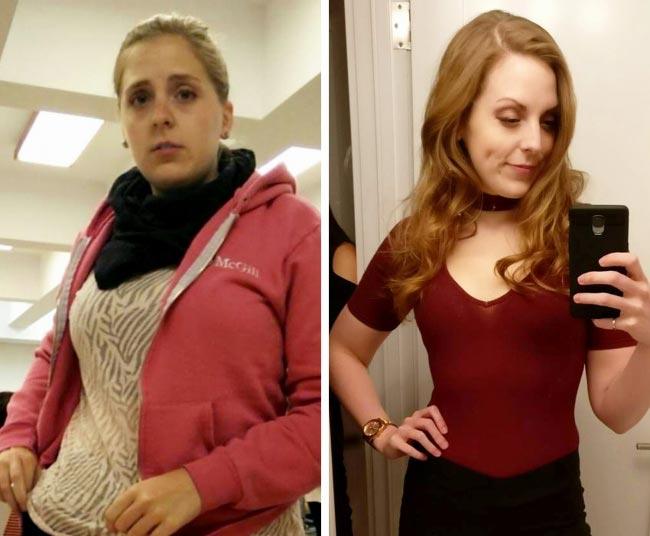 до и после похудения, невероятное похудение