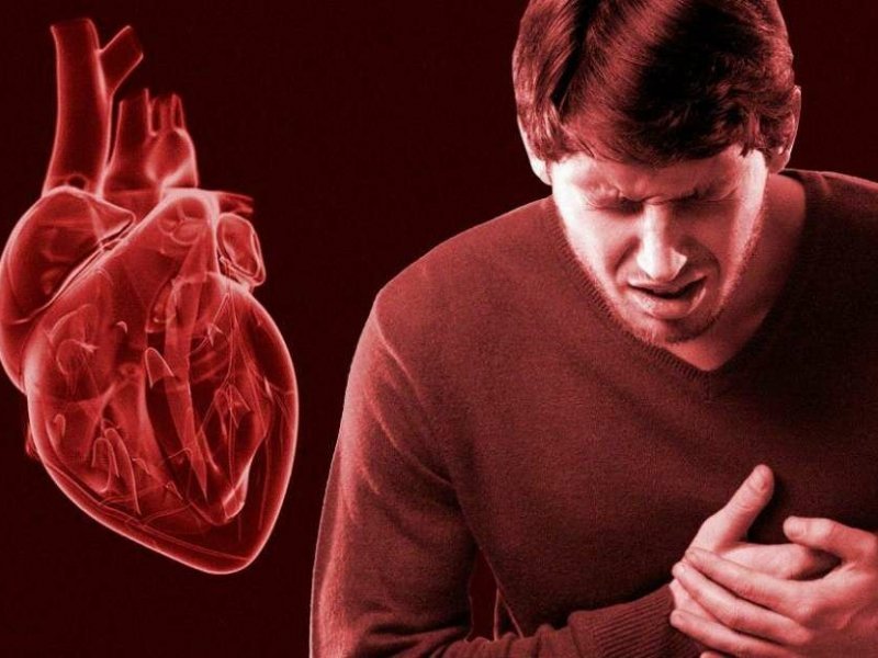 Люди не распознают сердечные приступы, когда симптомы появляются медленно