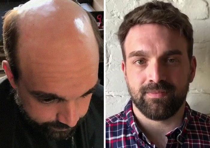 До и после: лысые мужчины посетили салон красоты. Фото