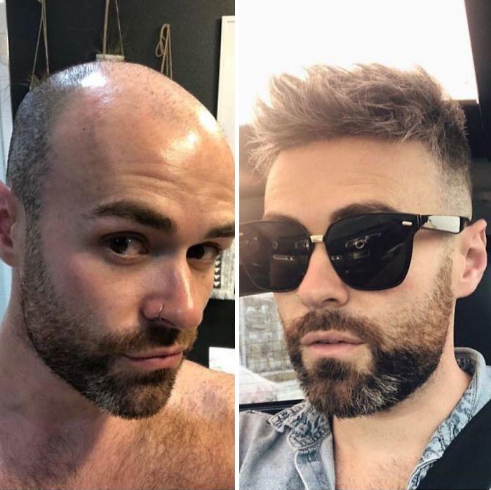 До и после: лысые мужчины посетили салон красоты. Фото