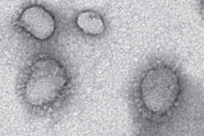 В Китае найден ближайший родственник вируса атипичной пневмонии