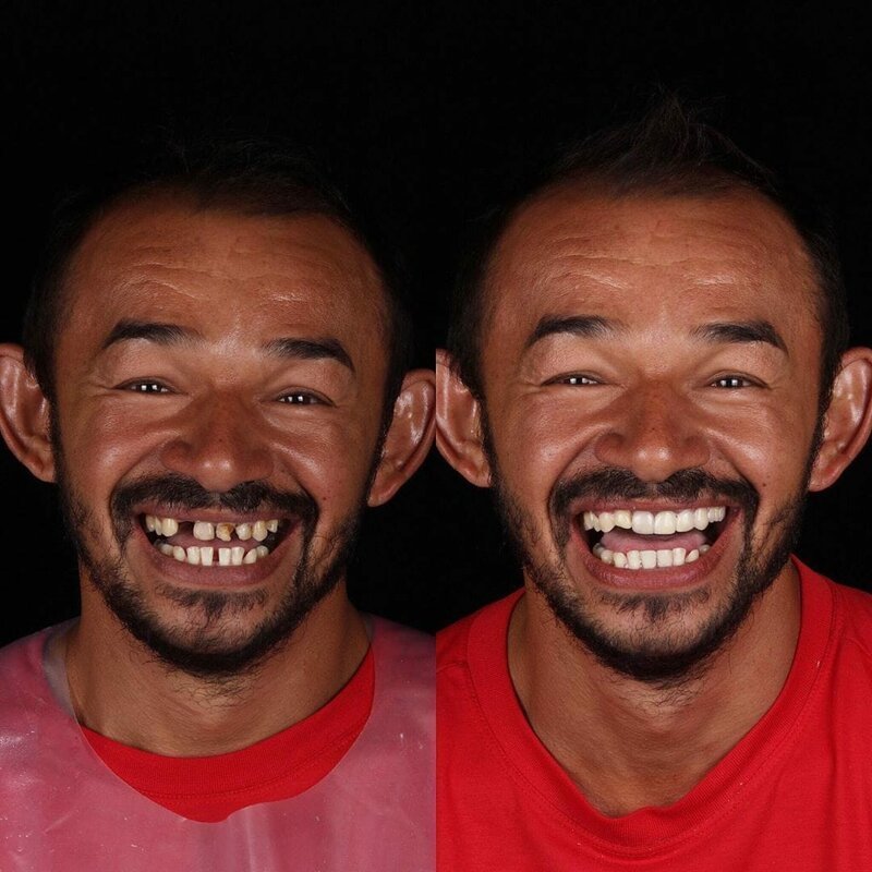 Стоматолог лечит зубы и меняет улыбки людей