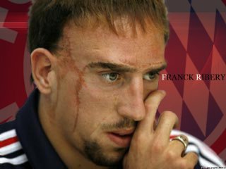 Украинские футболисты травмировали лидера сборной Франции