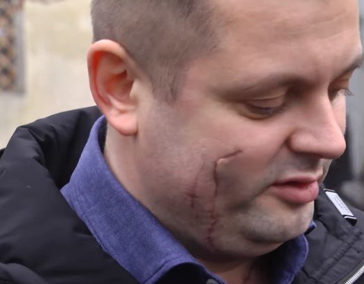 Харьковского полицейского, обменявшего себя на заложницу, наградили оружием. ФОТО